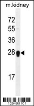 ARL5C Antibody (N-term)