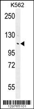 ANKRD18B Antibody (N-term)