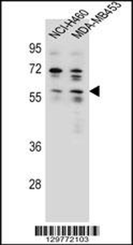 ANKRD34C Antibody (C-term)