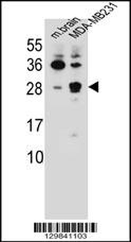 CBLN2 Antibody (C-term)