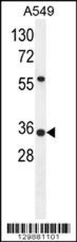 ANKRD58 Antibody (C-term)