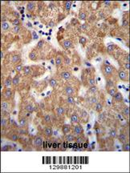 ANKRD58 Antibody (C-term)