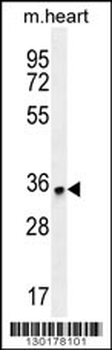 ZNF524 Antibody (C-term)