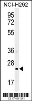 GSTA3 Antibody (N-term)