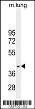 RNF215 Antibody (C-term)