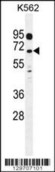 LRRC63 Antibody (C-term)