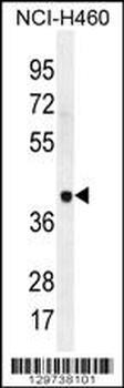 LRRC38 Antibody (C-term)