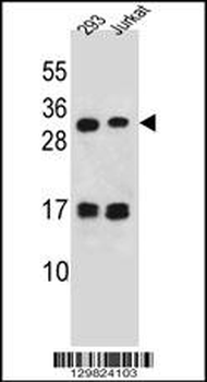 LOC339742 Antibody (C-term)