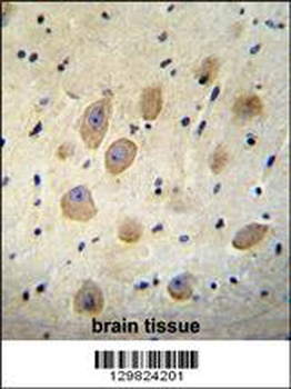 LOC339742 Antibody (C-term)