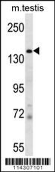 JHDM2a Antibody (N-term)