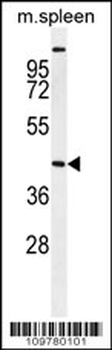 STK32A Antibody (N-term)