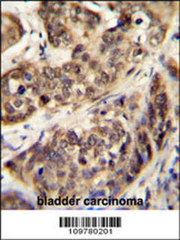 STK32A Antibody (N-term)