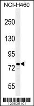 RAD54 Antibody (C-term)