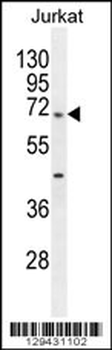TBC1D3H Antibody (N-term)