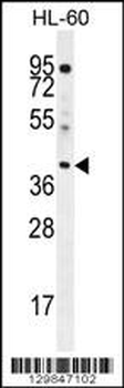 ELMD2 Antibody (C-term)