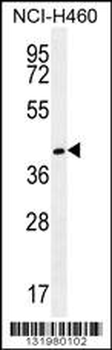 GGH Antibody (C-term)