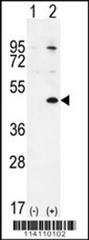 TGIF1 Antibody (Center L223)