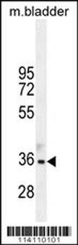 TGIF1 Antibody (Center L223)