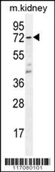 CYP5A1 Antibody (Center)