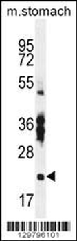 RBPMS2 Antibody (Center)