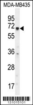 KCNQ1 Antibody (N-term)