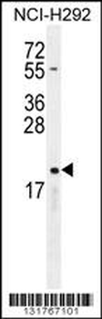 CYBA Antibody (C-term)