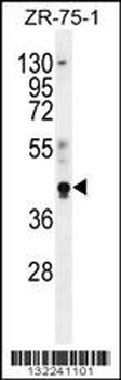 PYGO1 Antibody (C-term)