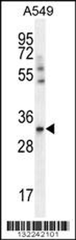 SLC25A6 Antibody (Center)