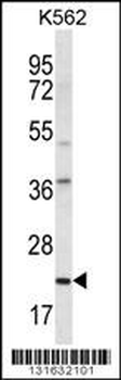 HLA-DQA1 Antibody (Center)