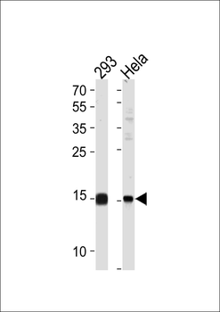 SUMO2/3 Antibody (C-term E69)