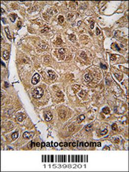 SUMO2/3 Antibody (C-term E69)