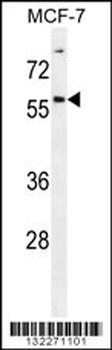 ZNF165 Antibody (Center)