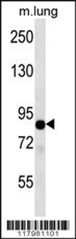 TLE2 Antibody (C-term)