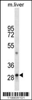 TPSAB1 Antibody (C-term)