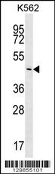 PLCXD2 Antibody (Center)