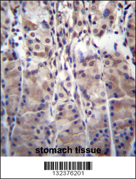 MDM1 Antibody (C-term)