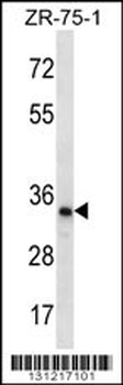 TLCD2 Antibody (C-term)
