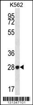 ZNF146 Antibody (N-term)