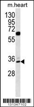 ZNF146 Antibody (N-term)