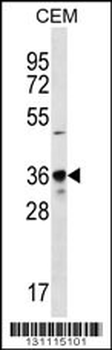 PDC Antibody (Center)