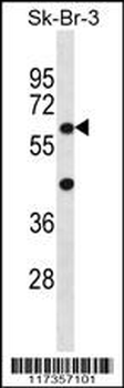 STXBP3 Antibody (Center)