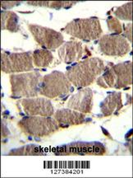 PION Antibody (C-term)