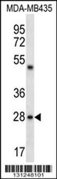 CDRT15L2 Antibody (C-term)