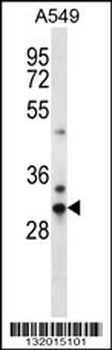 CDRT15L1 Antibody (Center)