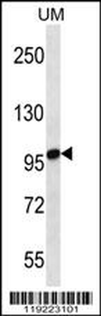STIM2 Antibody (N-term)