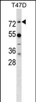 MX1 Antibody (Center)