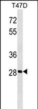 GK5 Antibody (N-term)