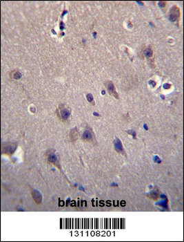 MCF2 Antibody (C-term)