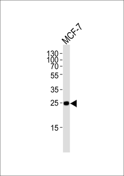 CDKN1B-Y88 Antibody