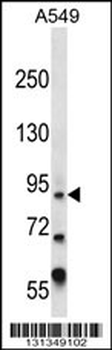 ZFY Antibody (Center)
